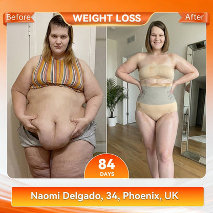💝NREOEO®Moringa & Berberine 4-in-1 Microparticle Sculpting & Fat-Burning Shorts