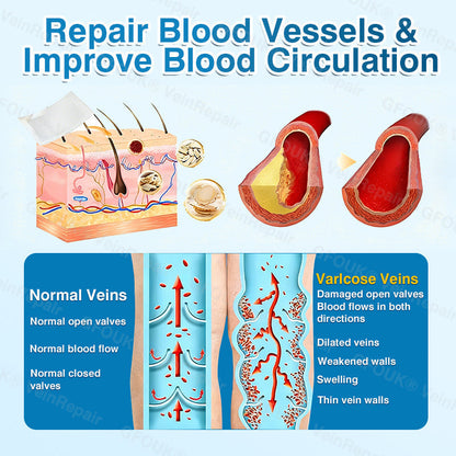 🇨🇦🏆✅️🏃GFOUK® VeinRepair Microneedle Patch Roll⚡Instant Relief, Long-Term Results