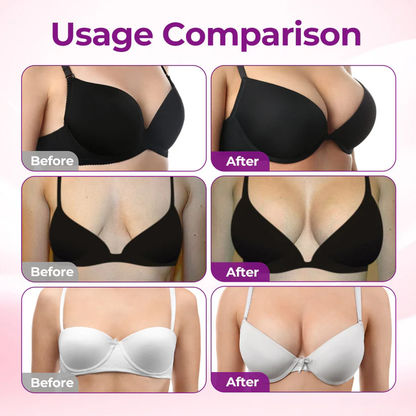 💧💥Nreoeo® 👩‍⚕️ Targeted Breast Enhancement Advanced Nano Microneedle Patch💃