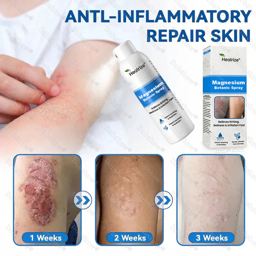 🔥Nreoeo® Magnesium Botanic Spray – Advanced Skin Recovery for Psoriasis & Eczema | Rapid Soothing, Steroid-Free