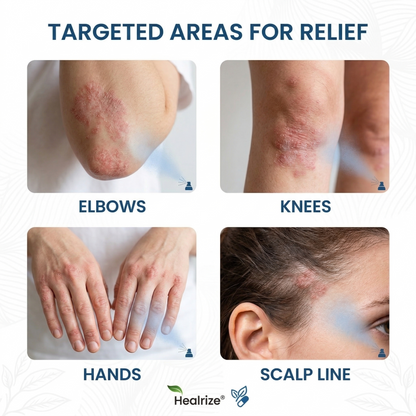 🔥Nreoeo® Magnesium Botanic Spray – Advanced Skin Recovery for Psoriasis & Eczema | Rapid Soothing, Steroid-Free