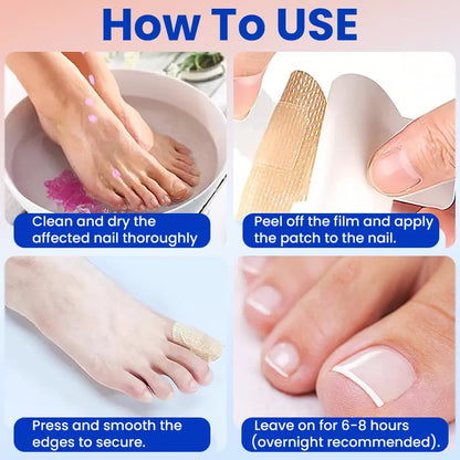 42 Pcs Toenail Treatment Extra Strength 8-Hour Overnight Nail Fast Acting Repair