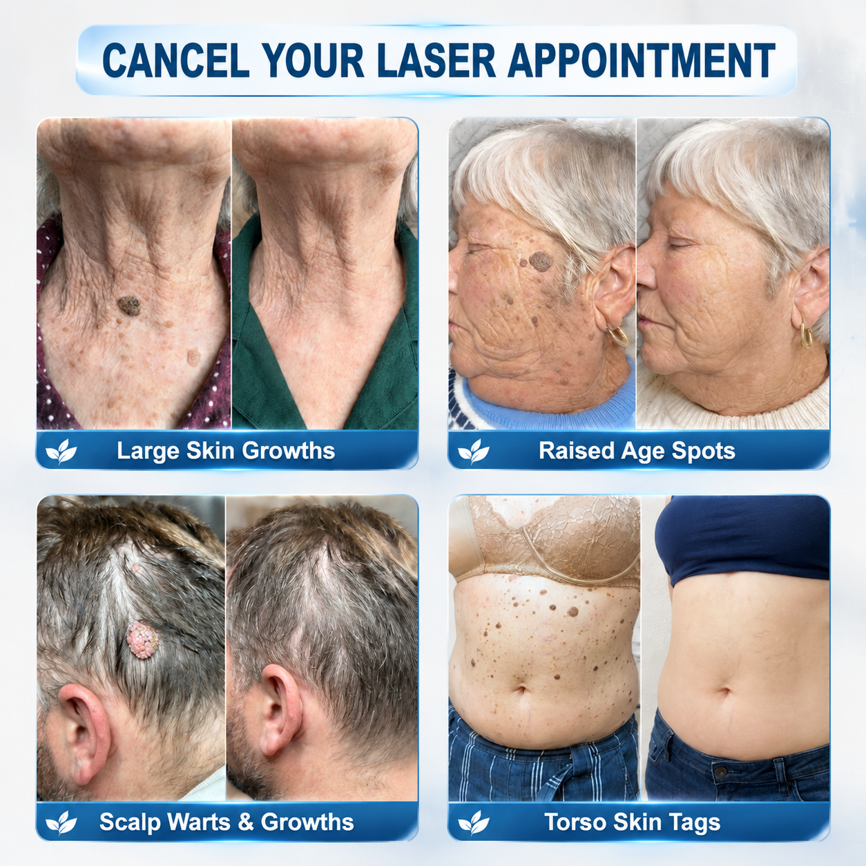 𝐎𝐟𝐟𝐢𝐜𝐢𝐚𝐥 𝐁𝐫𝐚𝐧𝐝 𝐒𝐭𝐨𝐫𝐞 |🧿Nreoeo® 7-𝐷𝑎𝑦 𝗧𝐚𝐠 & 𝗦𝗽𝐨𝐭 𝐄𝐫𝒂𝒔𝒆𝒓(Zero Pain, Zero 𝐒𝐜𝐚𝒓𝒔 Rollerball)💦