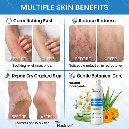 🔥Nreoeo® Magnesium Botanic Spray – Advanced Skin Recovery for Psoriasis & Eczema | Rapid Soothing, Steroid-Free