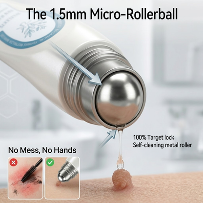 𝐎𝐟𝐟𝐢𝐜𝐢𝐚𝐥 𝐁𝐫𝐚𝐧𝐝 𝐒𝐭𝐨𝐫𝐞 |🧿Nreoeo® 7-𝐷𝑎𝑦 𝗧𝐚𝐠 & 𝗦𝗽𝐨𝐭 𝐄𝐫𝒂𝒔𝒆𝒓(Zero Pain, Zero 𝐒𝐜𝐚𝒓𝒔 Rollerball)💦