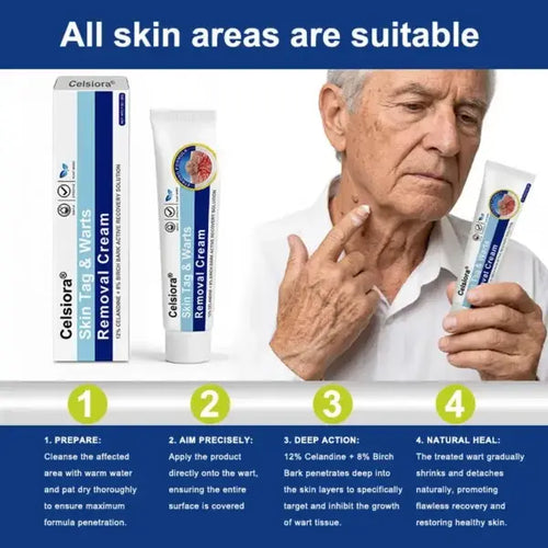 ✨😍Nreoeo® Targeted Skin Tag & Wart Removal Cream – Time-Released Phyto-Exfoliant (12% Celandine ) & Bio-Active Terpene Viral-Inhibitor (8% Thuja)