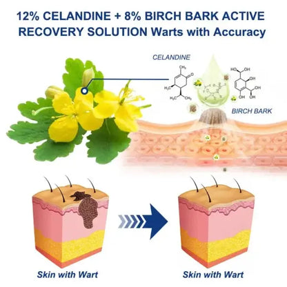 ✨😍Nreoeo® Targeted Skin Tag & Wart Removal Cream – Time-Released Phyto-Exfoliant (12% Celandine ) & Bio-Active Terpene Viral-Inhibitor (8% Thuja)