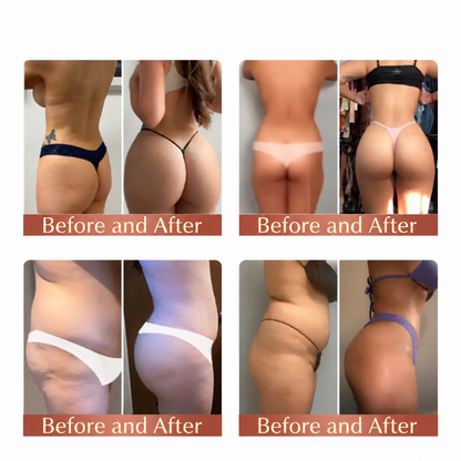 Nreoeo™ CurveSculpt Micro-Patch ✦ Sculpt • Firm • Smooth Lower Body Curves ✦ Micro-Needle Infusion System